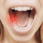 Що робити коли болить зуб а таблеток немає