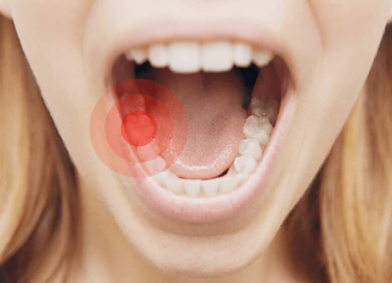 Що робити коли болить зуб а таблеток немає